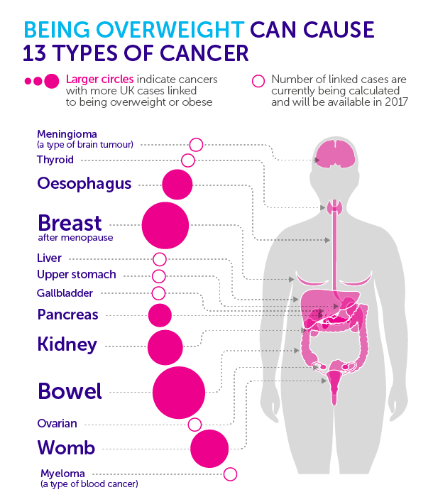 Obesity And Risk Of Cancer The Trend Is Disastrous Millennium Cancer Center 